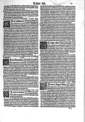 155