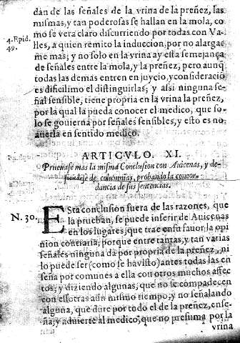 Articulo XI