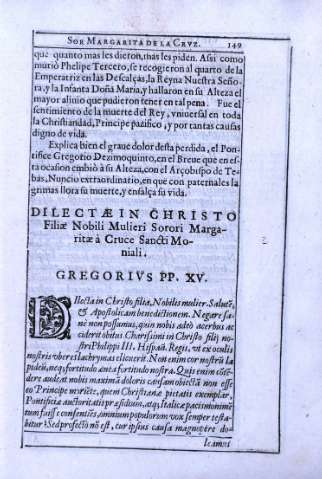 149