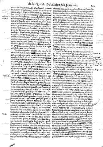 149